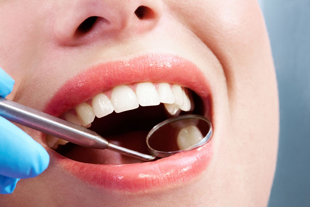 6 dental issues indicating high sugar intake